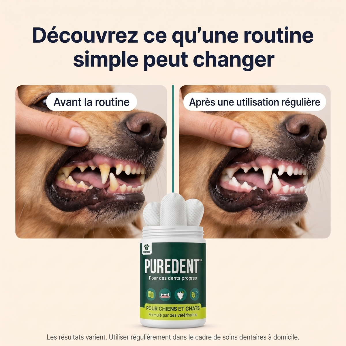 Lingettes dentaires PureDent™ : avant et après une utilisation régulière